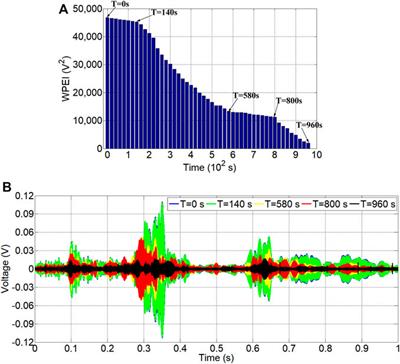 Old - New Concrete Interfacial Bond Slip Monitoring in Anchored Rebar Reinforced Concrete Structure Using PZT Enabled Active Sensing